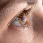 چشم ها را نمالید/ قوز قرنیه یکی از عوامل مالیدن مداوم چشم است